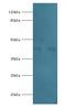 Acyl-CoA Dehydrogenase Short Chain antibody, MBS968811, MyBioSource, Western Blot image 