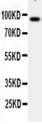 Colony Stimulating Factor 3 Receptor antibody, LS-C313492, Lifespan Biosciences, Western Blot image 