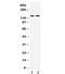 Transient Receptor Potential Cation Channel Subfamily M Member 5 antibody, R32340, NSJ Bioreagents, Western Blot image 