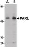 Presenilin Associated Rhomboid Like antibody, PA5-20579, Invitrogen Antibodies, Western Blot image 