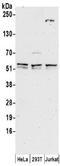 Thymine DNA Glycosylase antibody, NBP2-32248, Novus Biologicals, Western Blot image 
