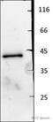 Major Histocompatibility Complex, Class I, E antibody, ab2216, Abcam, Western Blot image 