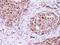RAD23 Homolog B, Nucleotide Excision Repair Protein antibody, NBP2-16825, Novus Biologicals, Immunohistochemistry frozen image 