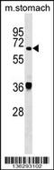 Tyrosyl-DNA Phosphodiesterase 1 antibody, 59-353, ProSci, Western Blot image 