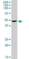 GATA Binding Protein 1 antibody, H00002623-M06, Novus Biologicals, Western Blot image 