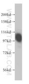 CD276 Molecule antibody, 14453-1-AP, Proteintech Group, Western Blot image 