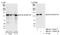 Splicing Factor 3b Subunit 2 antibody, NB100-79847, Novus Biologicals, Western Blot image 