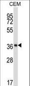 NFKB Inhibitor Beta antibody, LS-C164852, Lifespan Biosciences, Western Blot image 