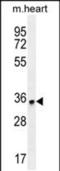 Zinc Finger Protein 524 antibody, PA5-48295, Invitrogen Antibodies, Western Blot image 