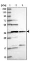 Family With Sequence Similarity 118 Member B antibody, PA5-59867, Invitrogen Antibodies, Western Blot image 
