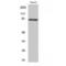 Rho Related BTB Domain Containing 1 antibody, LS-C385845, Lifespan Biosciences, Western Blot image 