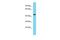 Tsukushi, Small Leucine Rich Proteoglycan antibody, PA5-46176, Invitrogen Antibodies, Western Blot image 