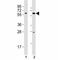 SRY-Box 10 antibody, F49359-0.4ML, NSJ Bioreagents, Western Blot image 