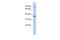 Heparan Sulfate-Glucosamine 3-Sulfotransferase 1 antibody, PA5-40647, Invitrogen Antibodies, Western Blot image 