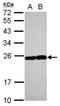 Ras-related protein Rab-17 antibody, GTX117846, GeneTex, Western Blot image 