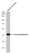 Carboxypeptidase B1 antibody, NBP1-32337, Novus Biologicals, Western Blot image 