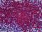 Growth Factor Receptor Bound Protein 2 antibody, LS-B5155, Lifespan Biosciences, Immunohistochemistry paraffin image 