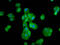 Mov10 Like RISC Complex RNA Helicase 1 antibody, LS-C680875, Lifespan Biosciences, Immunofluorescence image 