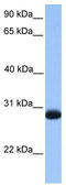 Zinc Finger Matrin-Type 3 antibody, TA339800, Origene, Western Blot image 