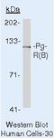 Progesterone Receptor antibody, MA5-12653, Invitrogen Antibodies, Western Blot image 
