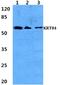Keratin 84 antibody, A14544, Boster Biological Technology, Western Blot image 