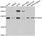 Proteasome Subunit Beta 8 antibody, abx006453, Abbexa, Western Blot image 