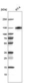 Lysosomal Associated Membrane Protein 1 antibody, AMAb91299, Atlas Antibodies, Western Blot image 