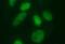 SUMO1 Activating Enzyme Subunit 1 antibody, MA5-26244, Invitrogen Antibodies, Immunocytochemistry image 
