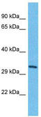 Transmembrane Protein 202 antibody, TA330789, Origene, Western Blot image 