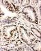 Interferon Regulatory Factor 1 antibody, PA2237, Boster Biological Technology, Immunohistochemistry paraffin image 