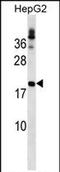 LHFPL Tetraspan Subfamily Member 6 antibody, PA5-72032, Invitrogen Antibodies, Western Blot image 