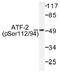 Activating Transcription Factor 2 antibody, AP01528PU-N, Origene, Western Blot image 