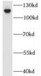 Interacts With SUPT6H, CTD Assembly Factor 1 antibody, FNab04429, FineTest, Western Blot image 