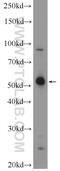 Mannosidase Endo-Alpha antibody, 21296-1-AP, Proteintech Group, Western Blot image 