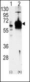 Guanylate Cyclase 1 Soluble Subunit Alpha 1 antibody, TA302112, Origene, Western Blot image 