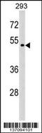 Purinergic Receptor P2X 6 antibody, 58-955, ProSci, Western Blot image 