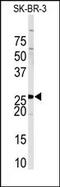 Sprouty RTK Signaling Antagonist 4 antibody, AP14094PU-N, Origene, Western Blot image 