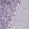 Chromosome 2 Open Reading Frame 49 antibody, HPA043846, Atlas Antibodies, Immunohistochemistry frozen image 