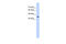 ST6 N-Acetylgalactosaminide Alpha-2,6-Sialyltransferase 5 antibody, ARP49986_T100, Aviva Systems Biology, Western Blot image 