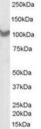 Proteasome 26S Subunit, Non-ATPase 2 antibody, MBS420621, MyBioSource, Western Blot image 