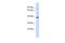 Rhomboid Like 2 antibody, PA5-43021, Invitrogen Antibodies, Western Blot image 