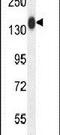 Collagen Type XIX Alpha 1 Chain antibody, PA5-23977, Invitrogen Antibodies, Western Blot image 