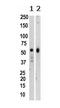 Lysine Methyltransferase 5A antibody, ab3798, Abcam, Western Blot image 