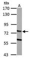 Hydroxyacyl-CoA Dehydrogenase Trifunctional Multienzyme Complex Subunit Alpha antibody, GTX101177, GeneTex, Western Blot image 