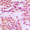 Histone Deacetylase 1 antibody, LS-C352326, Lifespan Biosciences, Immunohistochemistry paraffin image 