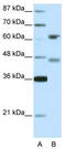 Regulatory Factor X4 antibody, TA332111, Origene, Western Blot image 