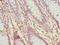 Serine Protease 35 antibody, CSB-PA839792LA01HU, Cusabio, Immunohistochemistry paraffin image 