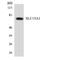 Solute Carrier Family 15 Member 1 antibody, A03672-1, Boster Biological Technology, Western Blot image 