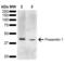 Presenilin 1 antibody, LS-C774722, Lifespan Biosciences, Western Blot image 