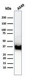 Annexin A1 antibody, GTX02590, GeneTex, Western Blot image 